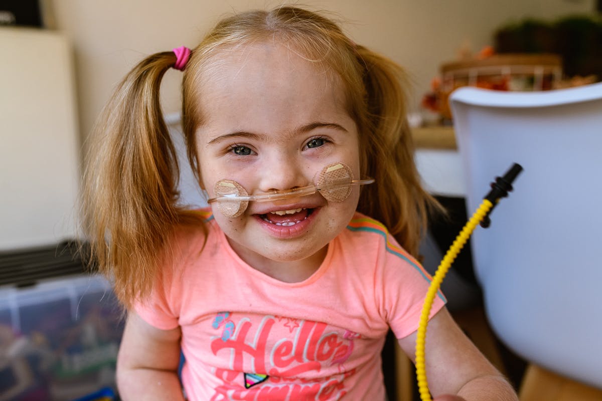 Blij meisje met Syndroom van Down