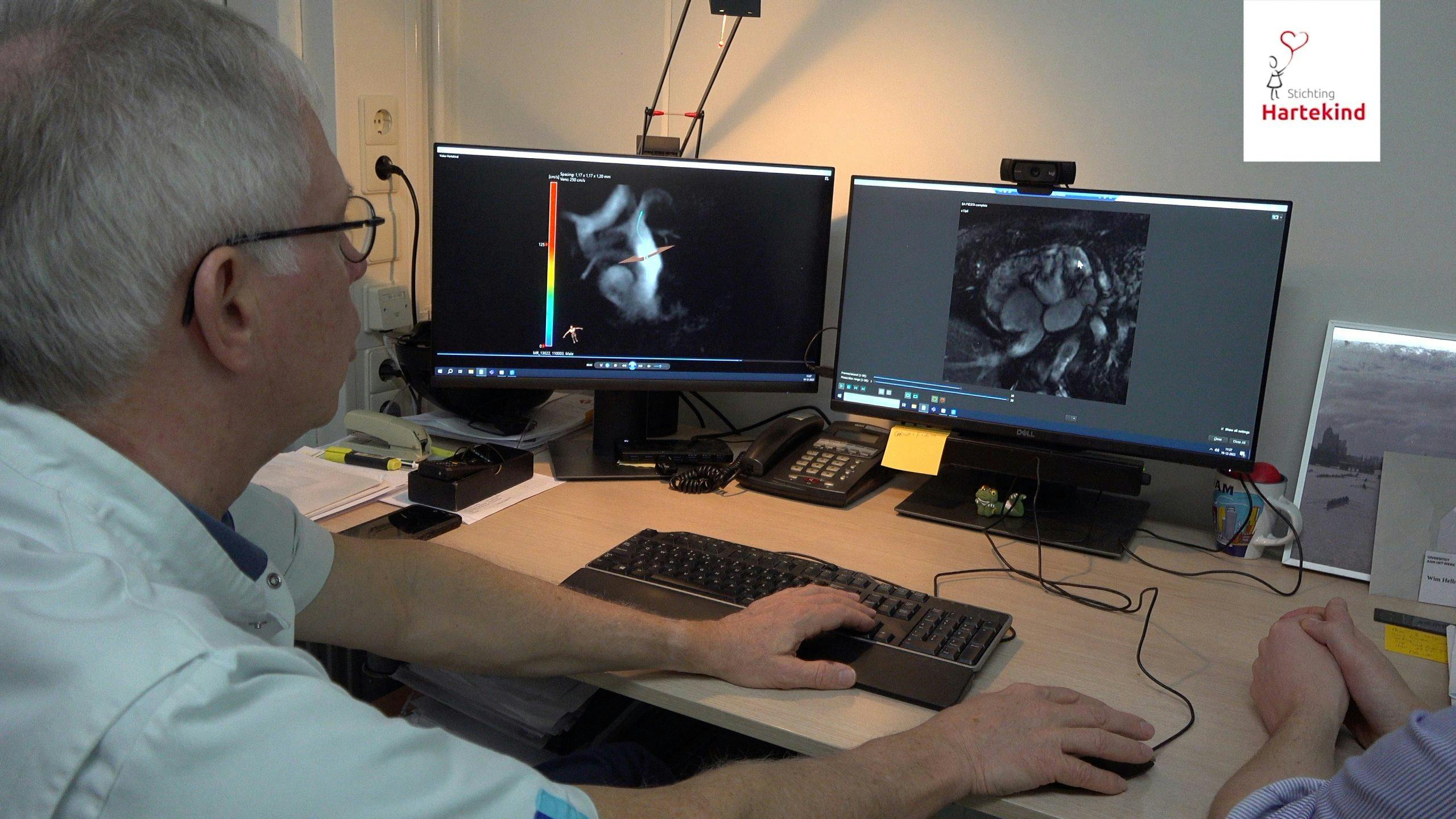 OUTREACH onderzoeksleider Wim Helbing bekijkt scans van een hart op een computer beeldscherm